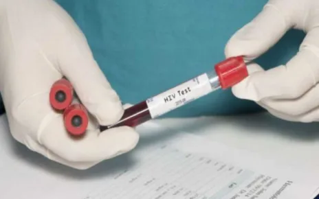 HIV test kit with blood sample