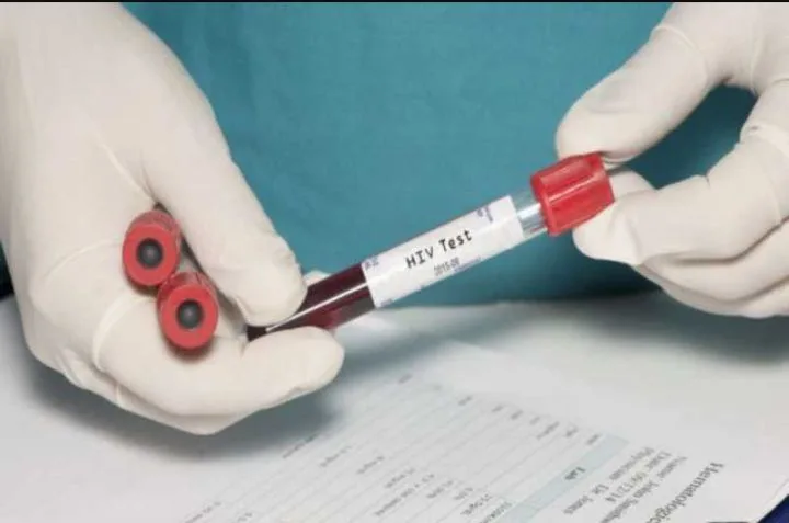 HIV test kit with blood sample